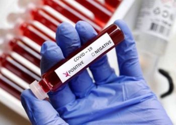 ରାଜ୍ୟରେ କମୁଛି ସଂକ୍ରମଣ, ୨୪ ଘଣ୍ଟା ମଧ୍ୟରେ ବାହାରିଲେ ୬୦ କରୋନା ପଜିଟିଭ୍‌