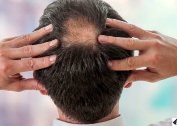 ଚନ୍ଦାପଣ ଦୂର କରିବାକୁ ଚାହୁଁଛନ୍ତୁ କି ? କରନ୍ତୁ ଏ ଭଳି କିଛି କାମ….