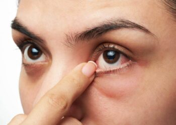 ଆସନ୍ତୁ ଜାଣିବା କିପରି ମଧୁମେହର ଲକ୍ଷଣ ଆଖିରେ ଦେଖାଯାଏ?