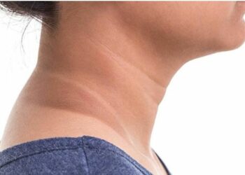 ଆପଣଙ୍କର ବେକରେ କଳା ଦାଗ ରହିଛି କି ? ଆପଣାନ୍ତୁ ଏହି ଘରୋଇ ଉପାୟ