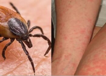 ଚିନ୍ତା ବଢାଉଛି ସ୍କ୍ରବ ଟାଇଫସ, ସୁନ୍ଦରଗଡରେ ଆଉ ୧୩ ଆକ୍ରାନ୍ତ