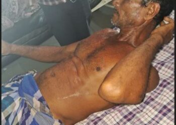 ବାପାପୁଅଙ୍କୁ ଏସିଡ ମାଡ