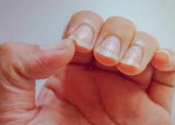 ନଖ ତଳେ ଲୁଚି ରହିଥାନ୍ତି ୩୨ ପ୍ରକାର ଜୀବାଣୁ !