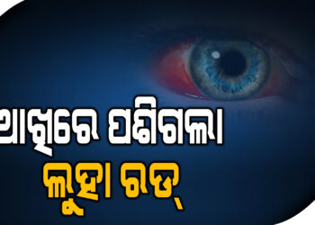 ଆଖିରେ ପଶିଗଲା ଲୁହା ରଡ୍